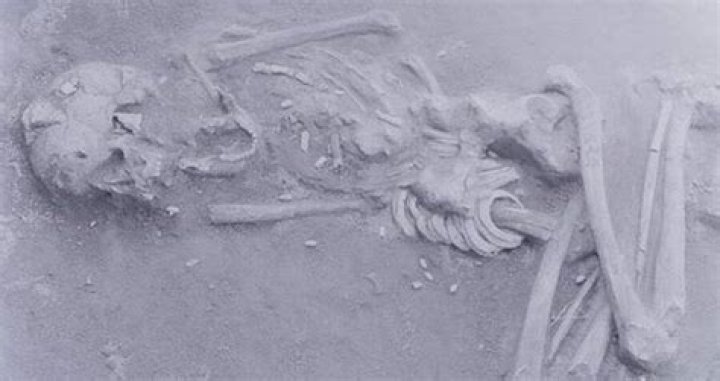 Did The Hirota People Of Japan Intentionally Deform Their Skulls?