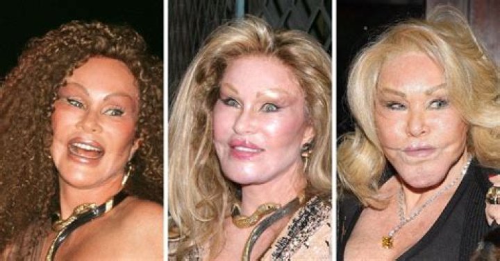 From Bad to WorseSee Jocelyn Wildenstein’s Shocking Plastic Surgery Transformation Right Before Your Eyes