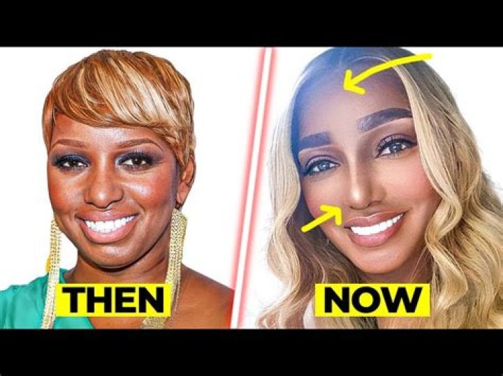 NeNe Leakes Sparks Plastic Surgery Rumors After Announcing Return to ‘RHOA’