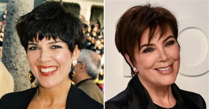 Plastic Surgery? See Kris Jenner’s Transformation and Quotes About Going Under the Knife